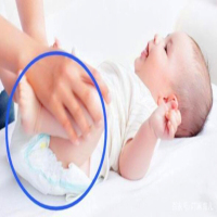 Vermeiden Sie die falsche Handlung, die Windeln des Babys zu wechseln (1)